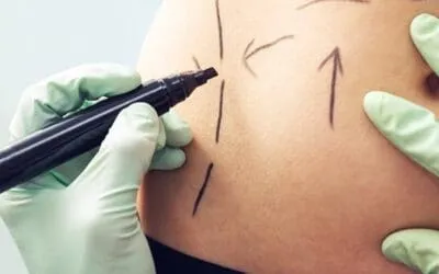 π±A New Beginning: #1 Post-Weight Loss Surgery in Tulsaπ€