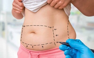 Kreitzberg Plastic Surgery Continues Offering High-Quality Mommy Makeover Surgery in Tulsa, OK