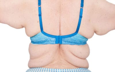 Transform Your Journey: #1 Post-Weight Loss Surgery in Tulsa