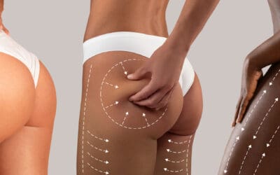 Kreitzberg Plastic Surgery Reinforces Its Dedication to Advanced #1 Body Contouring in Tulsa