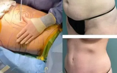 Kreitzberg Plastic Surgery Continues to Set the Standard for Excellence in Tulsa, OK