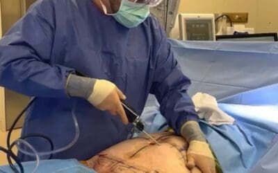 A Premier Source for Cosmetic Surgery in Tulsa, Oklahoma: Kreitzberg Plastic Surgery